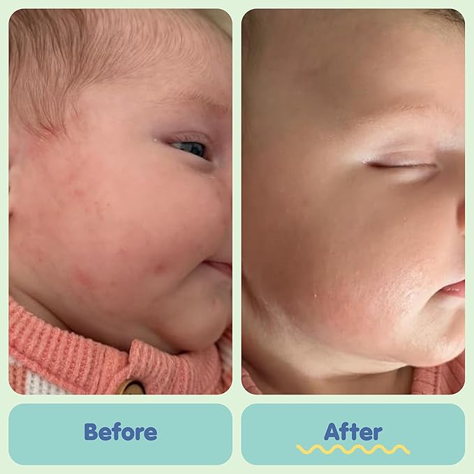 TUBBY TODD All Over Ointment - Baby Eczema Cream - Everyday Multi-Purpose Baby Skin Relief Cream - Sensitive Skin, Dry Skin, Rash, & Irritation - Steroid & Gluten Free - Lavender Rosemary, 2 Pack, 8oz